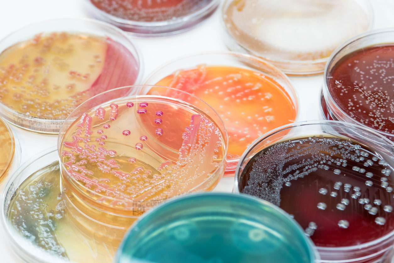 Bacterial colonies culture growth on selective media.