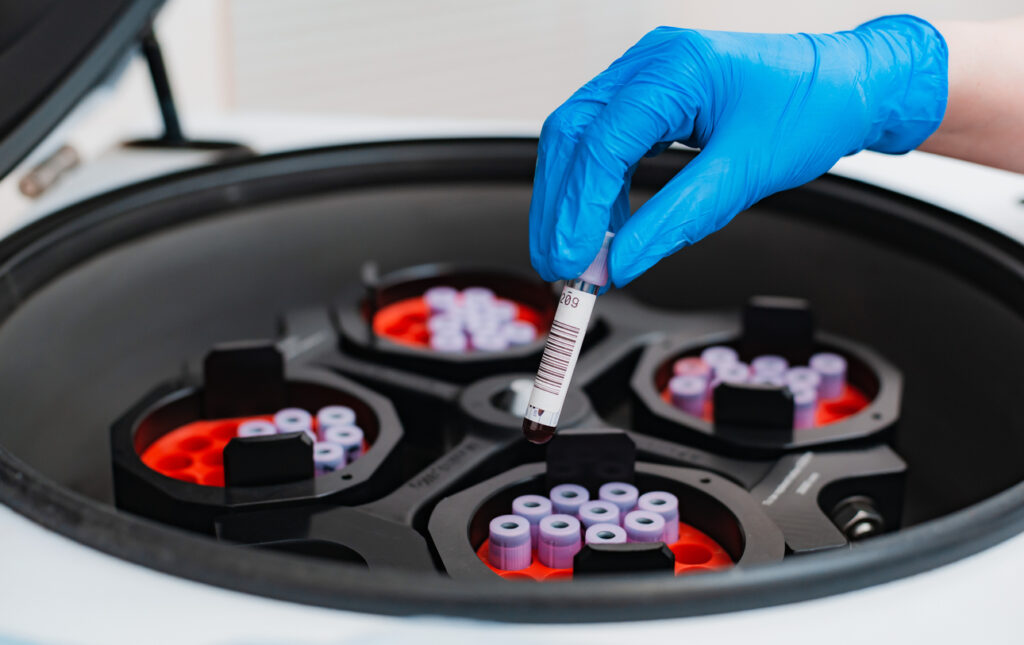 Gloved Hand Putting Vials into an Automated Centrifuge